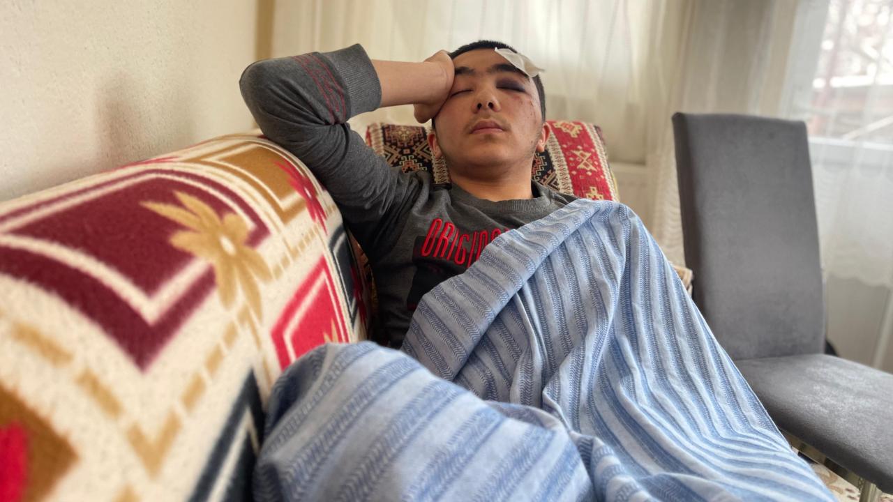 Isparta’da başıboş köpeklerin saldırdığı gencin kafatası çatladı