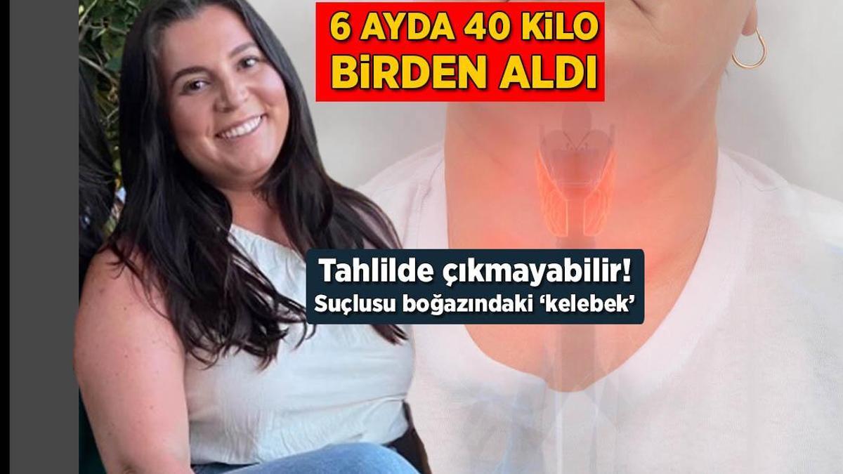 6 ayda 40 kilo birden aldı! Tahlilde çıkmayabilir, suçlusu boğazındaki ‘kelebek’